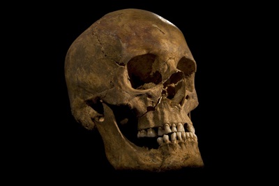 Skull - Richard III (Source: University of Leicester)
